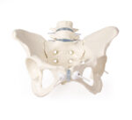 Naise vaagnaluu kahe nimmelüliga - Image 3